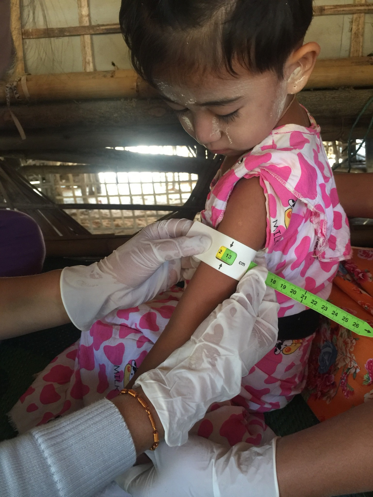 Zachraňujeme životy dětí, které trpí podvýživou v táborech pro vnitřní uprchlíky v Myanmaru 