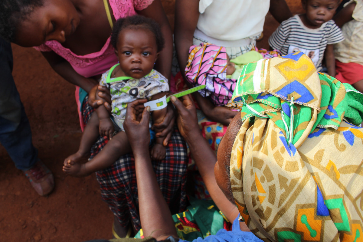 Léčba akutní podvýživy a podpora zdravotnických zařízení v oblasti Bijombo